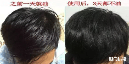 【吴彦祖】有一种尴尬叫“越发往后”的发际线!看完吴彦祖陈冠希,你就懂了