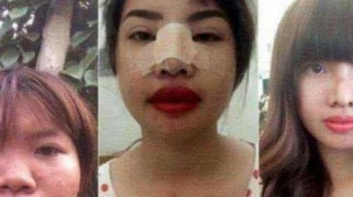 「袁华」那个整容后成功嫁给富二代的越南丑女，生下女儿被抛弃，如今怎么样了呢？