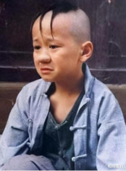 孟智超|为了演三毛，整天用胶水粘头发，年少秃顶为了植发忍痛扎400针