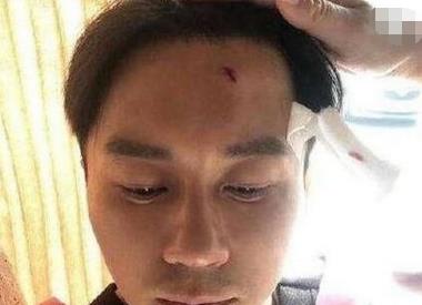 李晨@李晨缝了22针，而他昏迷6天不幸离世，节目意外该由谁负责？