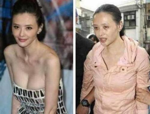 明星|毒品多可怕？明星吸毒前后对比图，不仅断送前程，模样更是大变样