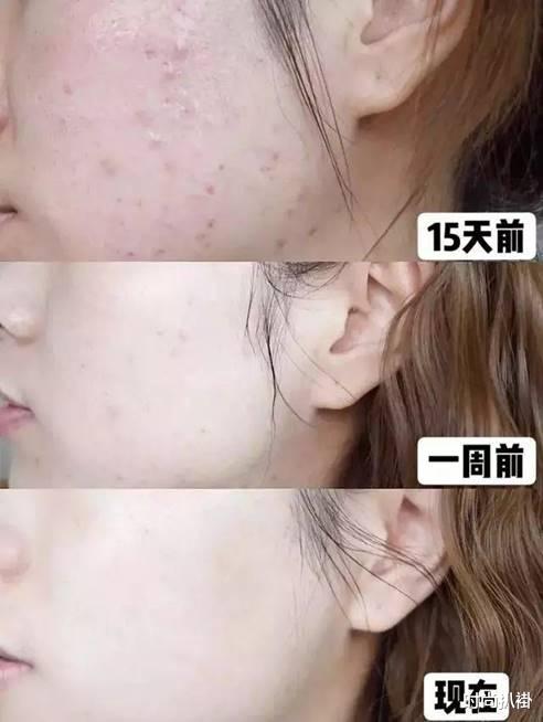 刘雯 32岁刘雯被曝谈恋爱，曾坦言：工作是自己的男朋友，爱自己就可以了
