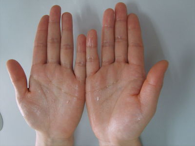 []肾脏“弱”的男孩子，身体这3处会“汗如雨下”，希望你一个也不占！