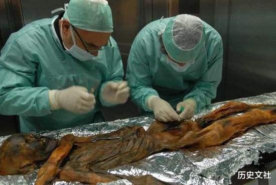 「木乃伊」阿尔卑斯山发现冰封5300年的木乃伊，体内留有箭头，他经历了什么