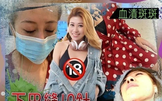 夜店遇袭 香港女歌手被外国女连踢数脚 下巴缝十针衣服血迹斑斑 生活资讯 早游戏