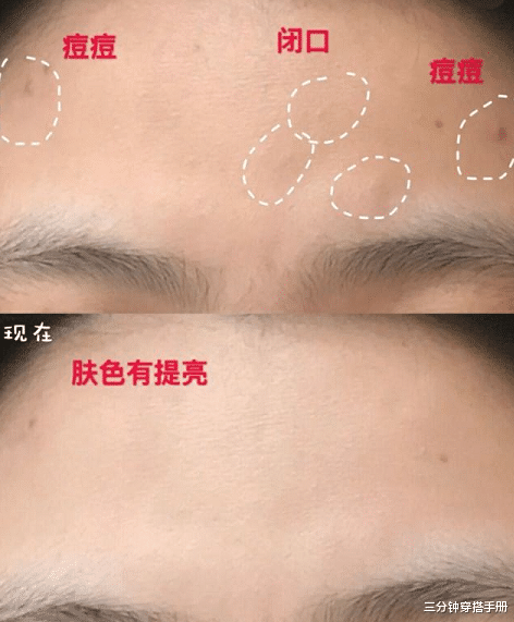 马鞭草 “好皮肤”和“好长相”到底哪个更重要？来看一下这个对比就知道了