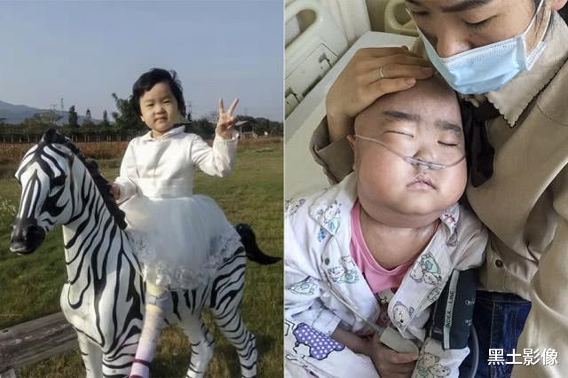 抗癌@7岁“小萝莉”患重症4年样貌大变,今被医生禁食3个月瘦成皮包骨