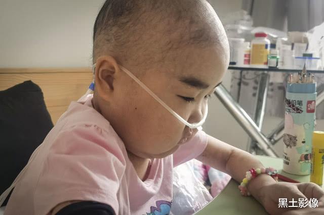 抗癌@7岁“小萝莉”患重症4年样貌大变,今被医生禁食3个月瘦成皮包骨