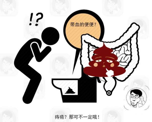 三伏天|排便时，若有三个表现，当心是肠癌来报道的信号，及时检查