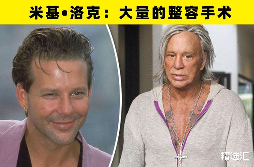 整形|大方承认自己做过整形手术的8名好莱坞明星