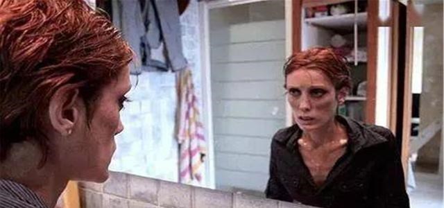 厌食症|女模特疯狂减肥得厌食症，变成骨架十分痛苦，到中国后却不药而愈