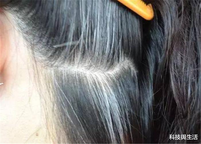 【科学家】人类头发变白是为什么?科学家找到真相,原来是它们在作祟!