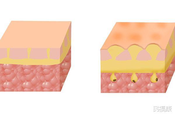 【睡眠质量】女人睡觉时，带着哪些东西入睡，等同于带病上身？劝你别大意