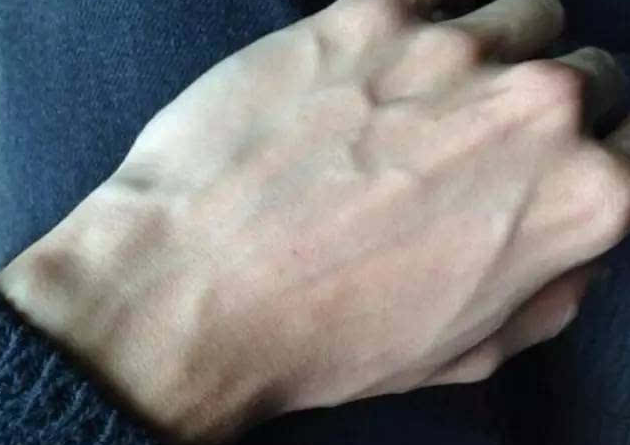 「长寿与衰老」体内废物越多，这几个部位青筋越明显！