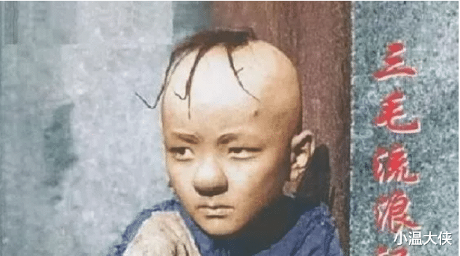 孟智超|他凭借“三毛”大火，因头皮受伤谢顶缝300针，今容貌大变无人识