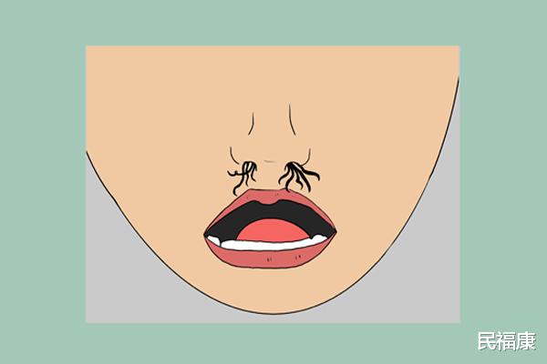 大脑|长出来的鼻毛，直接拔掉就行了？提醒：或许会出现2种意外