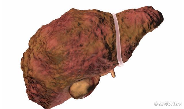 肝脏|脚上出现这三种信号,肝脏早已“烂如筛网”,请尽早检查