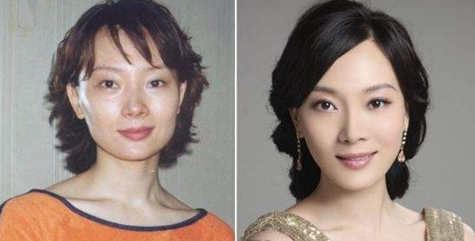 整容|“整容最成功”的4位女星，明明动过多少刀子，却看不出任何痕迹