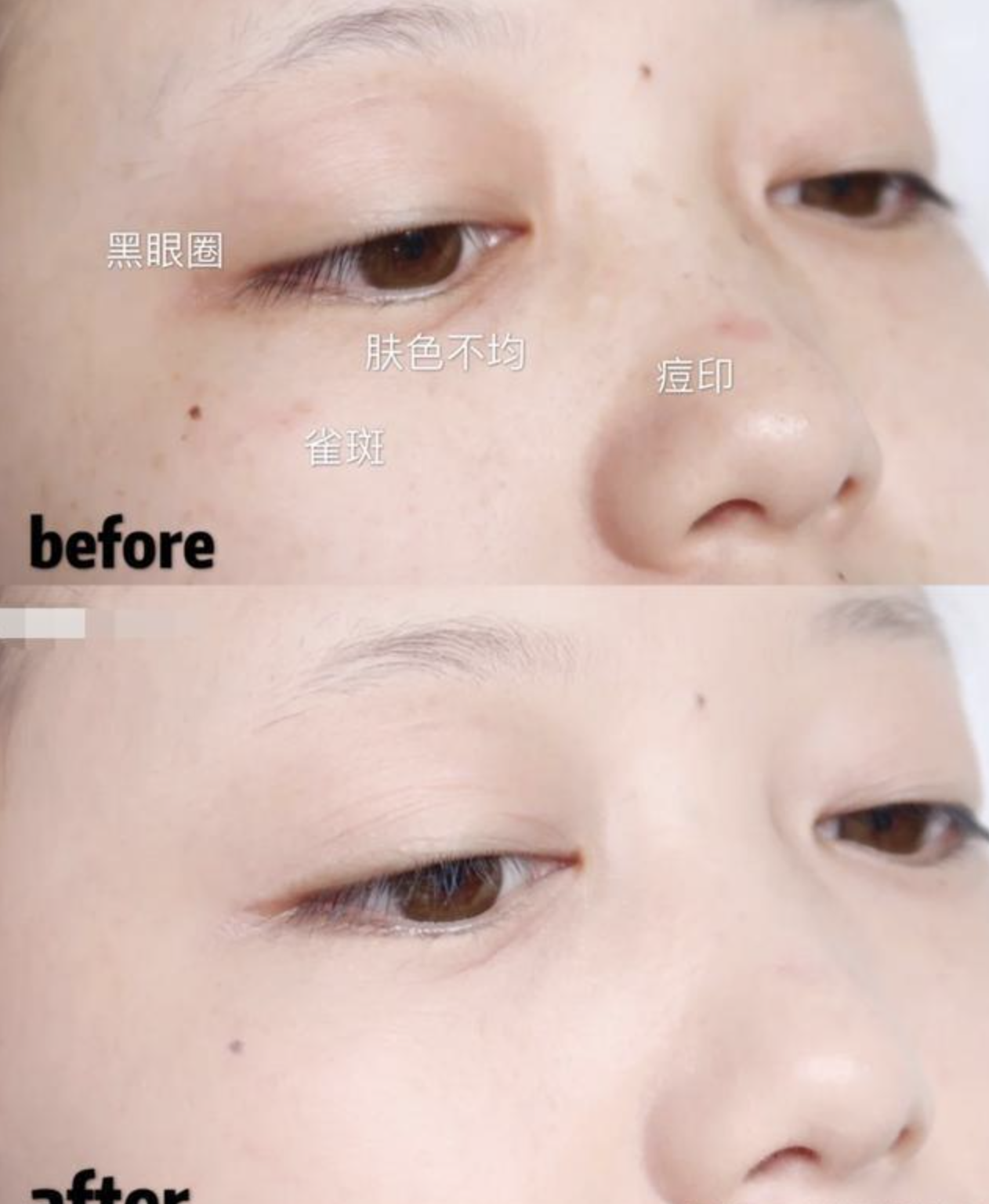 明星|明星特写是“照妖镜”？女星未修图下颜值不再，底妆斑驳卡粉严重