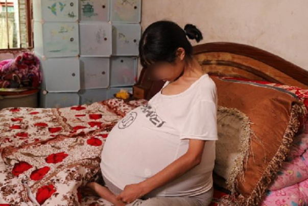 医生|女子肚子长“巨球”快爆开！四肢畸瘦只能坐着睡，医生摇头她绝望等死