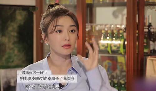 秦岚|秦岚素颜被“曝光”，整张脸居然都是疤？打了半个娱乐圈的脸