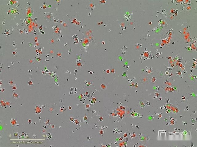 乳腺癌|阻止癌症复发？破解肿瘤细胞“休眠”很关键