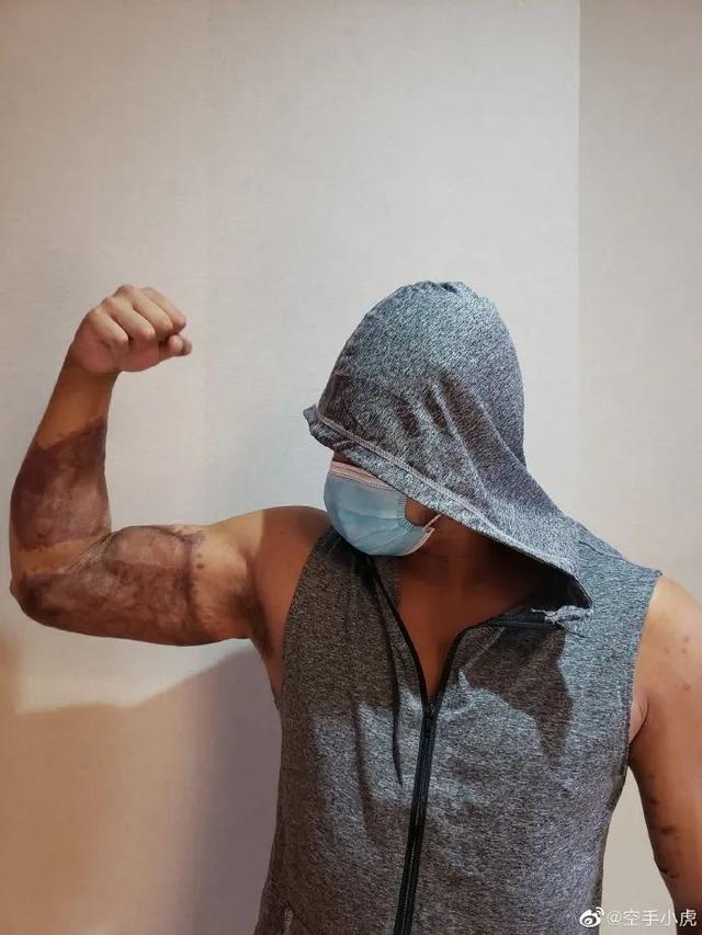 香港▲“我是暴徒创造的证物！”港警解下伤口纱布，这一幕太心疼