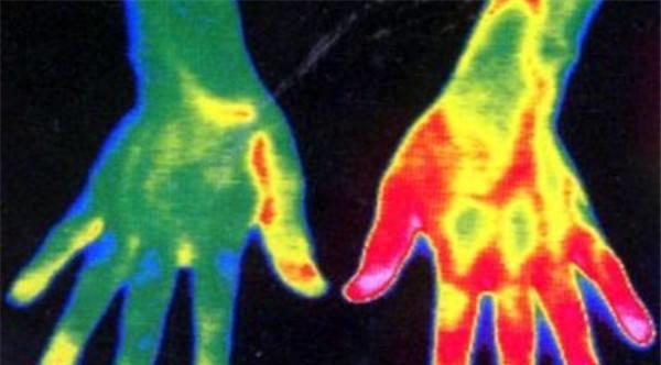 科学家|人体对1000℃高温不痛不痒，这是为什么？科学家揭示特殊其现象