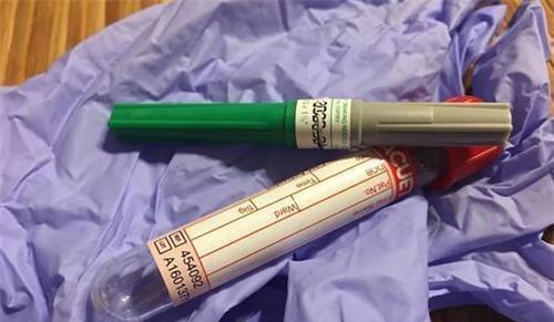 疾控■我国最罕见血型在江苏出现,已被国际基因库收录,全球仅此一例