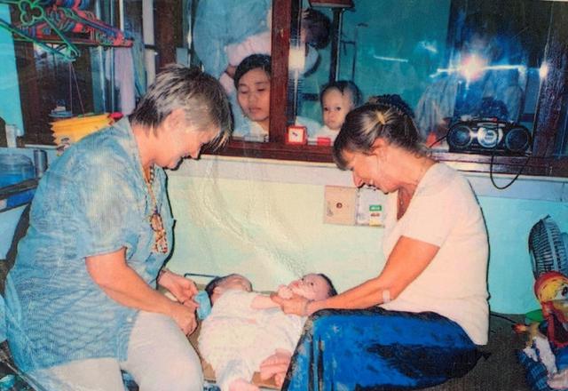 睹图|连体女婴经过10小时手术成功分开，17年后姐妹俩都考上大学