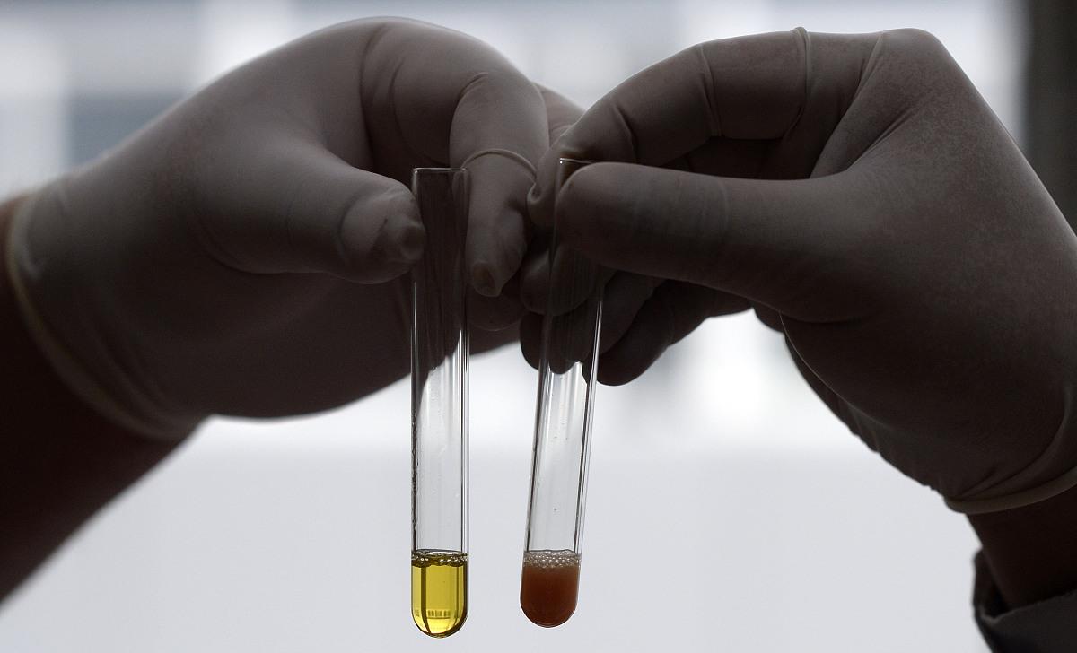 四川省|陈皮和它是“绝配”，用来泡水喝，养肝排毒，气色红润显年轻