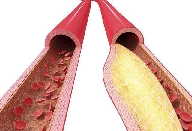 #胃镜#寿命短的男人,一般有5处变硬,3处变小,若你没有,那就恭喜了