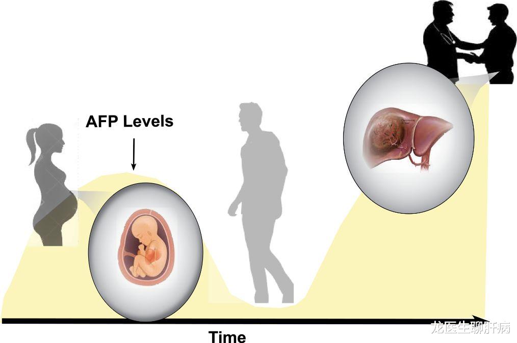 肝癌|如果肝硬化变肝癌了，身体会发出什么“信号”吗？听听医生怎么说