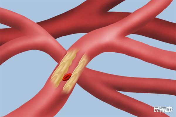 降血脂：血液黏稠，身体早有马脚露出，若是都占了，该降血脂了