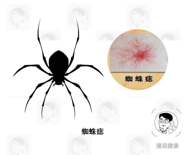 疾病|体内有癌，四肢先知？四肢出现4个迹象，最好去医院检查一下