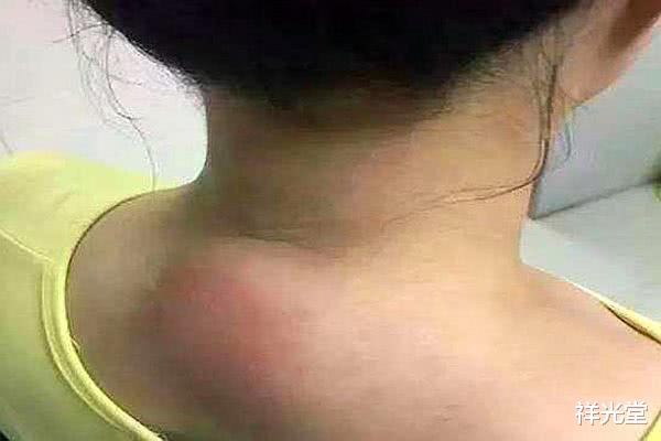 【奶油】寿命短的人，或有两处“凸出”，无论男女都一样，快来对照一下