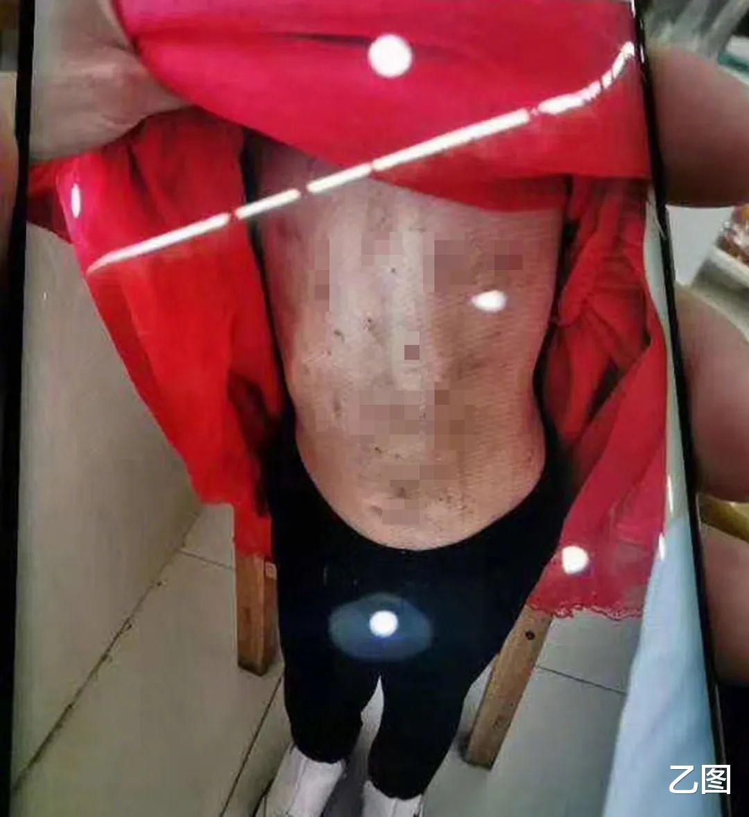 『套路贷』男童被虐昏迷3年，继母生父获刑16年和3年，却唤不醒“继母们”