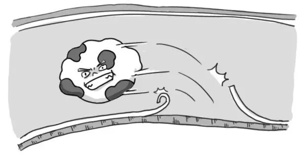 『老年病』好好的血管，怎么说堵就堵？