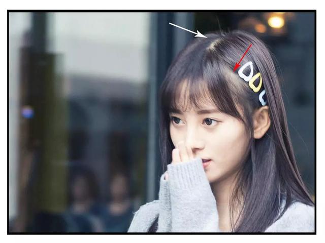 鞠婧祎■鞠婧祎是连头皮都整了?看到她头发缝那一刻,怀疑眼睛