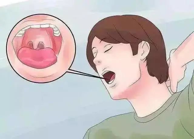 「脂肪酸」55岁男子,脑梗复发离世,医生提醒:3类食物最好少往嘴里塞