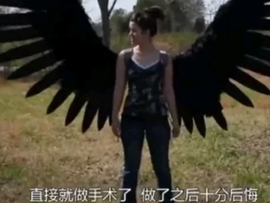『』外国女子从小就想飞起来，不顾一切花百万在背上装翅膀，后来怎样