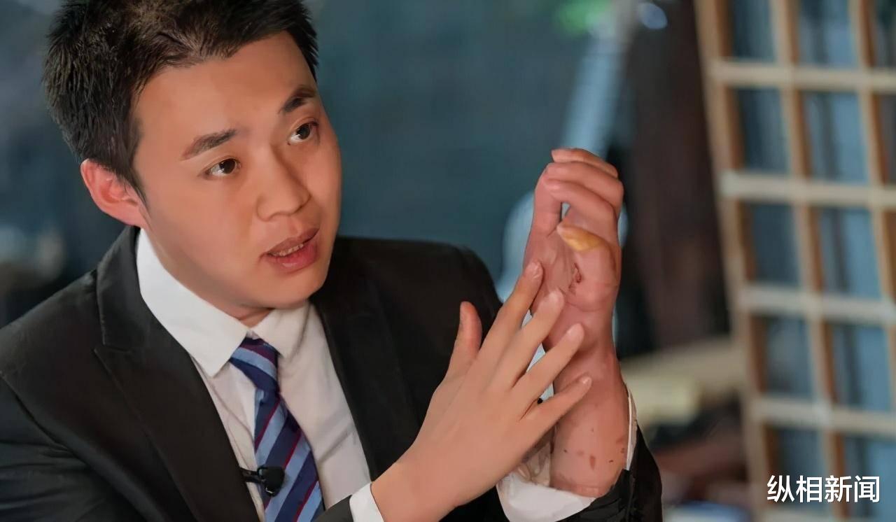 纵相新闻|陶勇医生回来了！自嘲治病的手像“鸡爪”，心愿仍是“天下无盲”