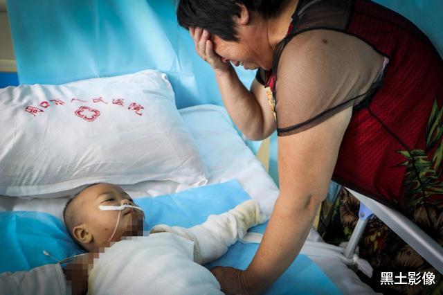 黑土影像|农村奶奶一个粗心孙女烫成“木乃伊”，吓得痛哭：怎么跟媳妇交代？