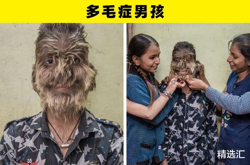 |非凡的人类：拥有极其特别外貌的5个人类