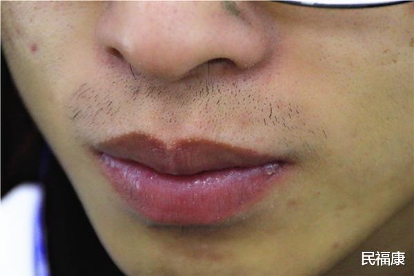 雄激素|为何鼻毛总是“冒”出鼻外，说明了什么？能不能直接拔掉？