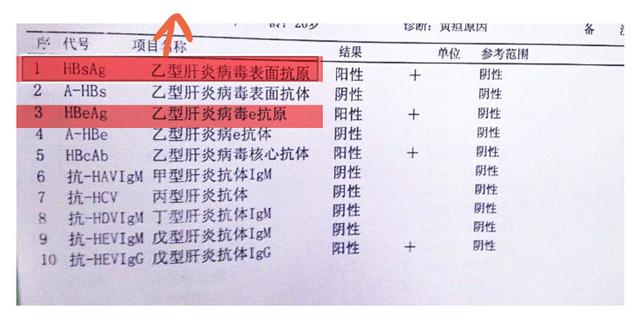 乙肝|张文宏说乙肝能临床治愈，那为什么还有携带者7000多万？