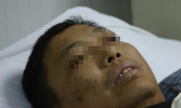 肝脏|若身体经常出现三个异常，别以为是肠道出问题，可能是肝脏变硬了