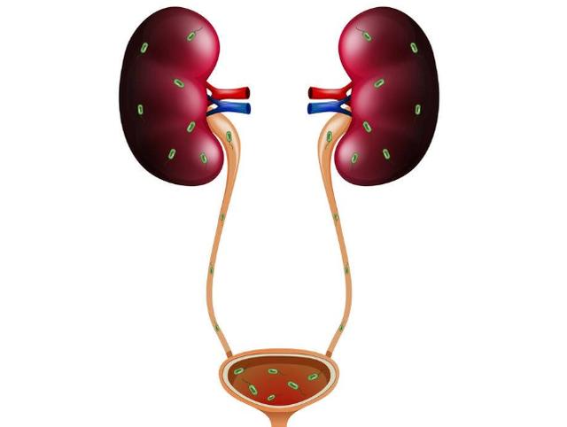 #尿毒症#肾不好的人，身体若有4个异常，当心“尿毒症”来敲门，别忽视！