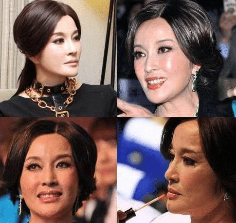 王心凌|?“被玻尿酸毁容”的六大女星，王心凌像老太婆，她却丑到让人无法接受