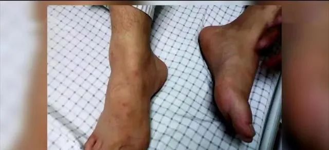 红火蚁@遇到这种小红土堆，千万别碰！广东各地都有